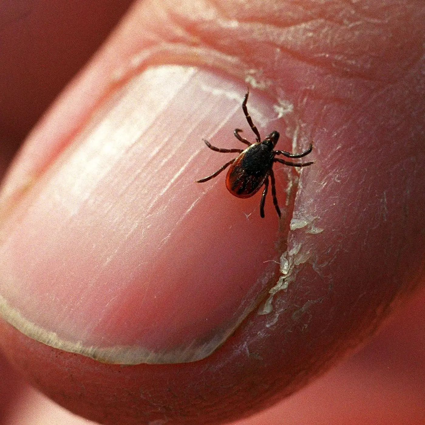 The most effective remedy for ticks has been found. Research proves it is reliable