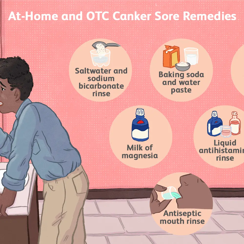 The most effective ways to get rid of canker sores and thrush in children