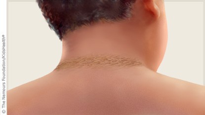 The neck looks dirty, but that could be a warning signal from your body