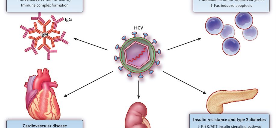 The NHF regulation is dangerous for HCV patients