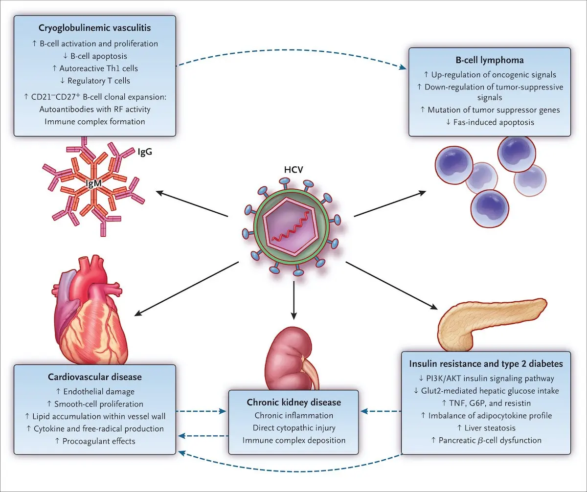 The NHF regulation is dangerous for HCV patients