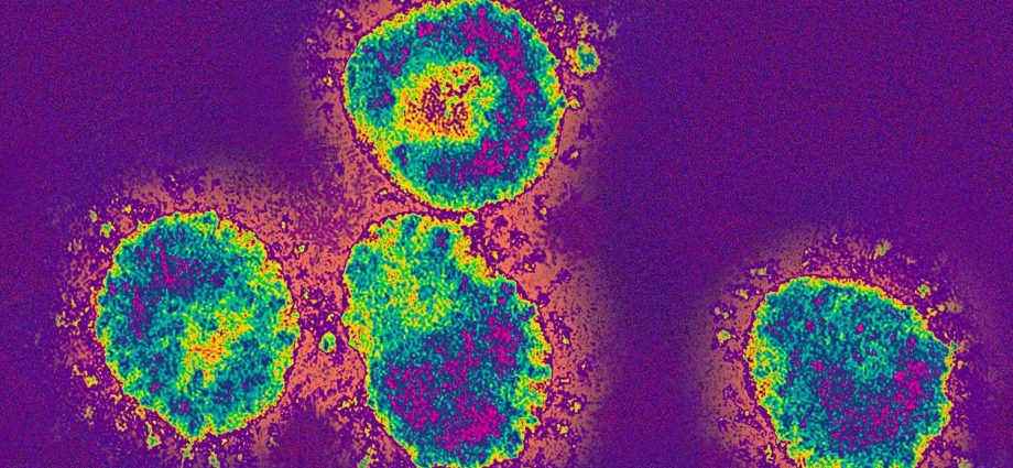 The Pasteur Institute &#8220;lost&#8221; samples of the SARS virus