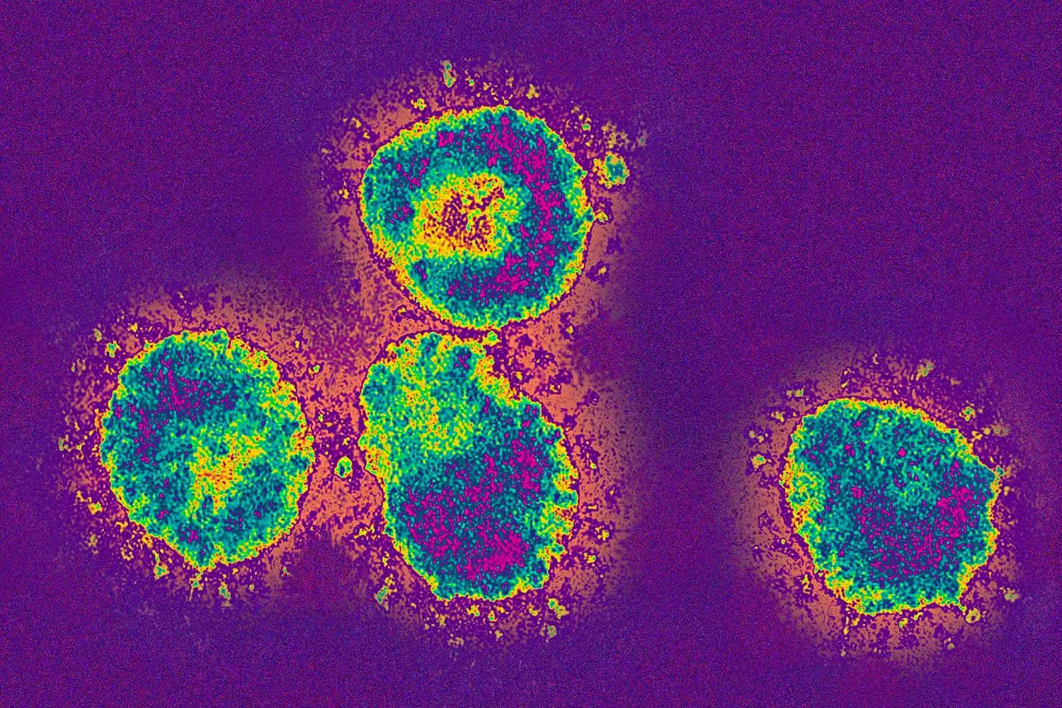 The Pasteur Institute &#8220;lost&#8221; samples of the SARS virus