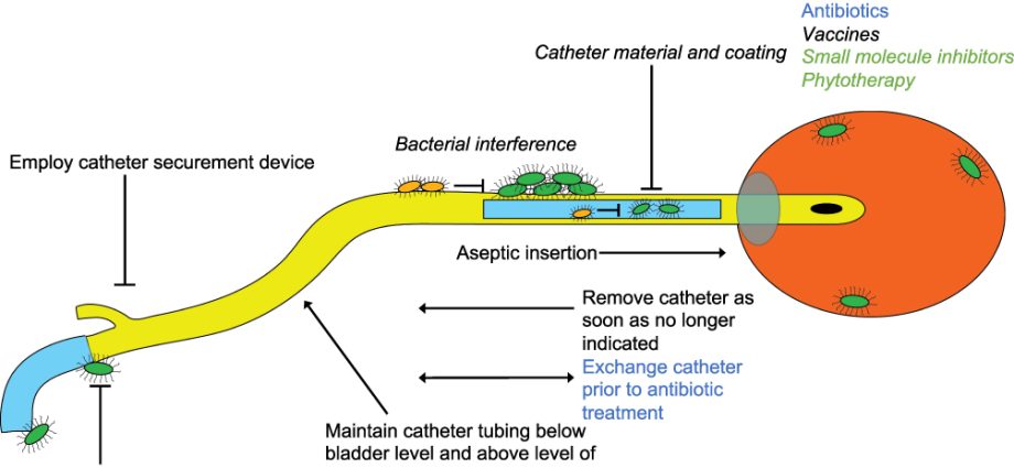 The path of bacteria from the catheter to the patient&#8217;s body