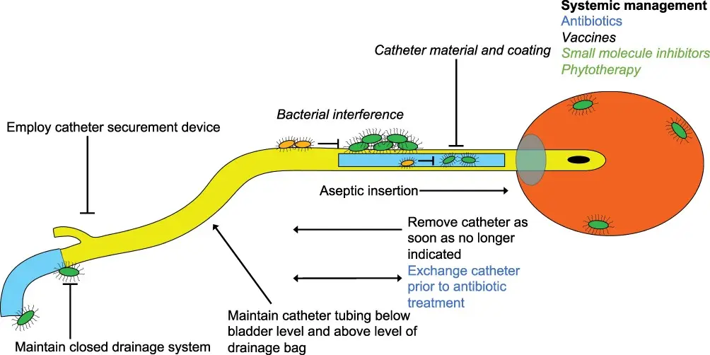 The path of bacteria from the catheter to the patient&#8217;s body