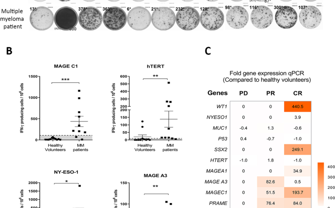 The patient with myeloma was cured for the first time with measles viruses