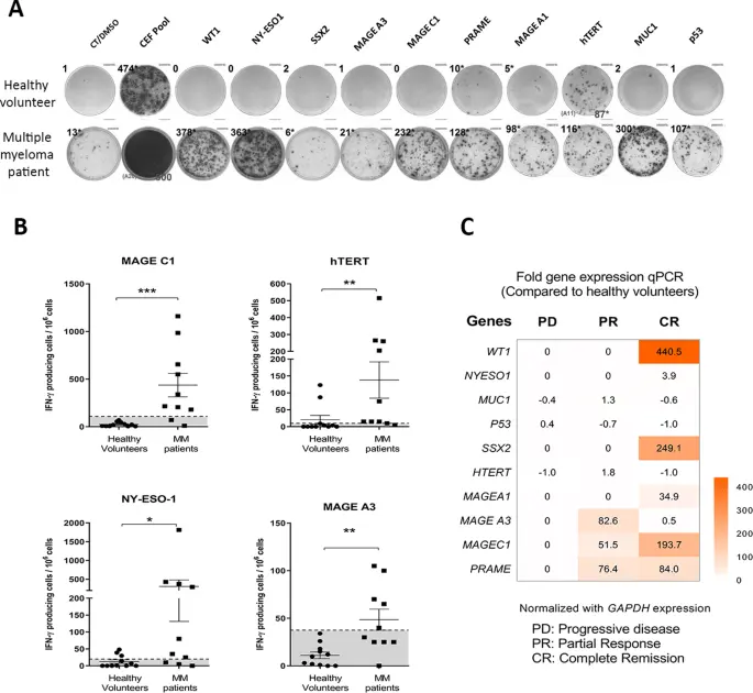 The patient with myeloma was cured for the first time with measles viruses