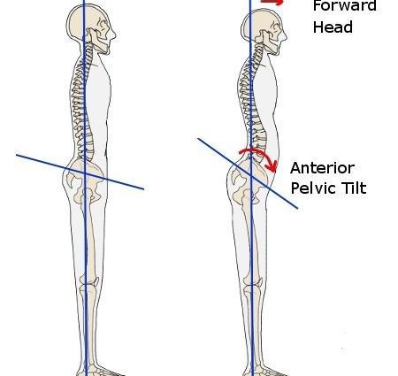 The pelvic position