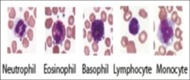 The percentage formula of white blood cells (peripheral blood smear) &#8211; when to perform the test, interpretation of the results, price