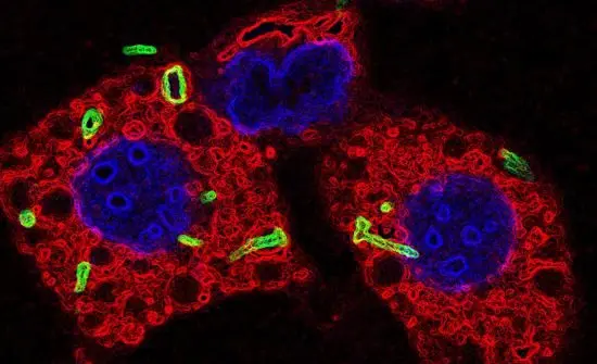 The protein reveals a link between tuberculosis and Parkinson&#8217;s disease