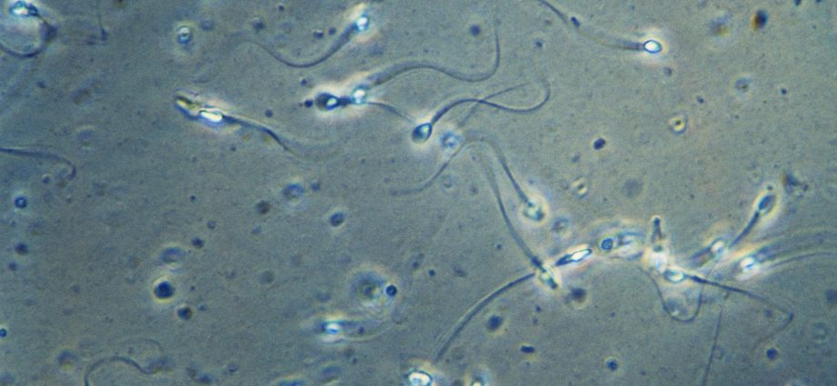 The quality of the sperm is getting worse. Find out what harms sperm