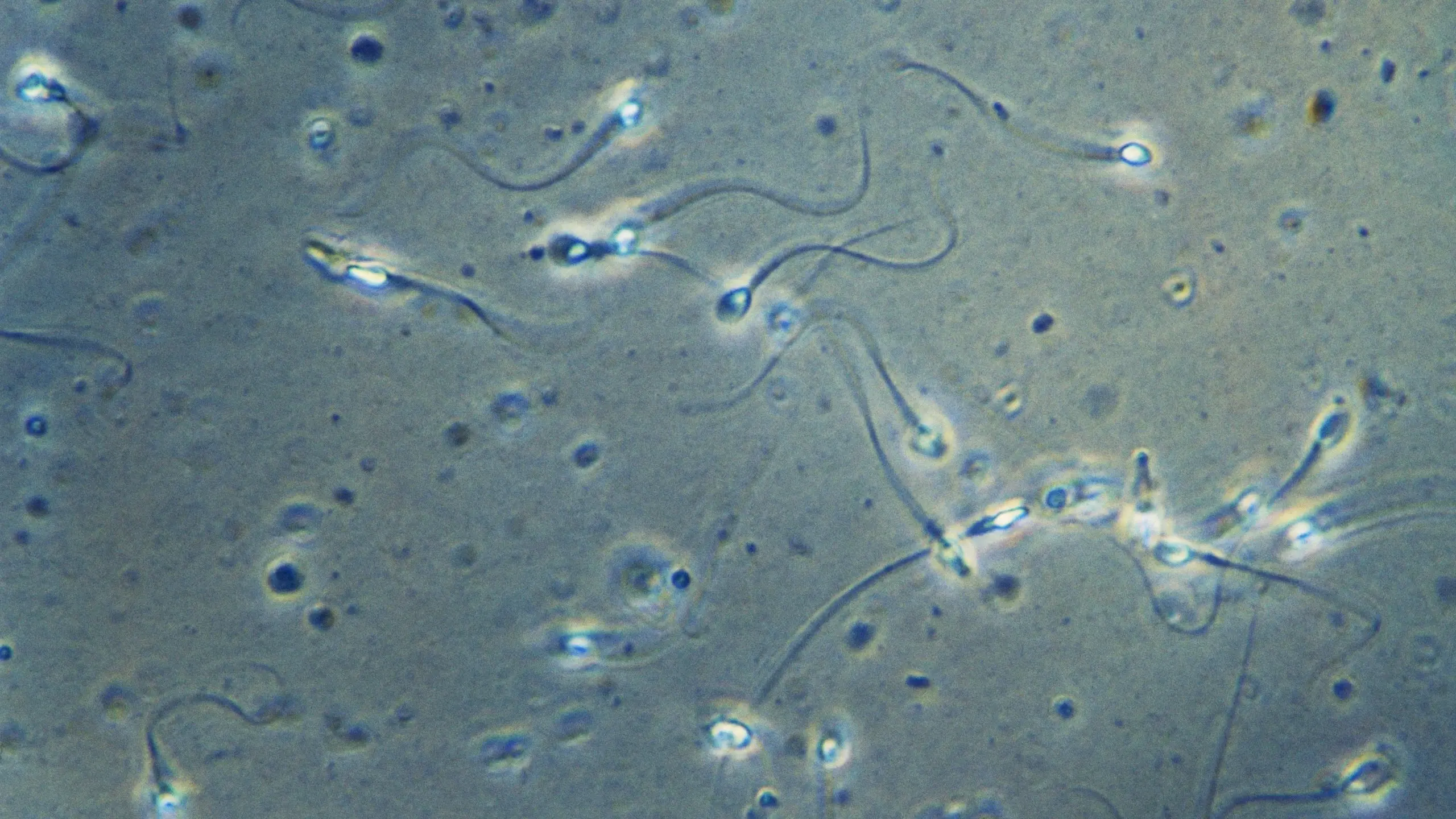 The quality of the sperm is getting worse. Find out what harms sperm