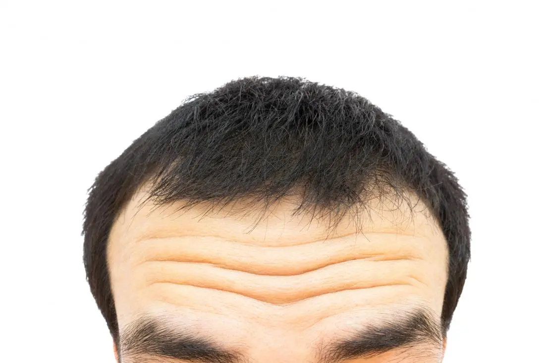 The risk of heart disease can be written… on your forehead