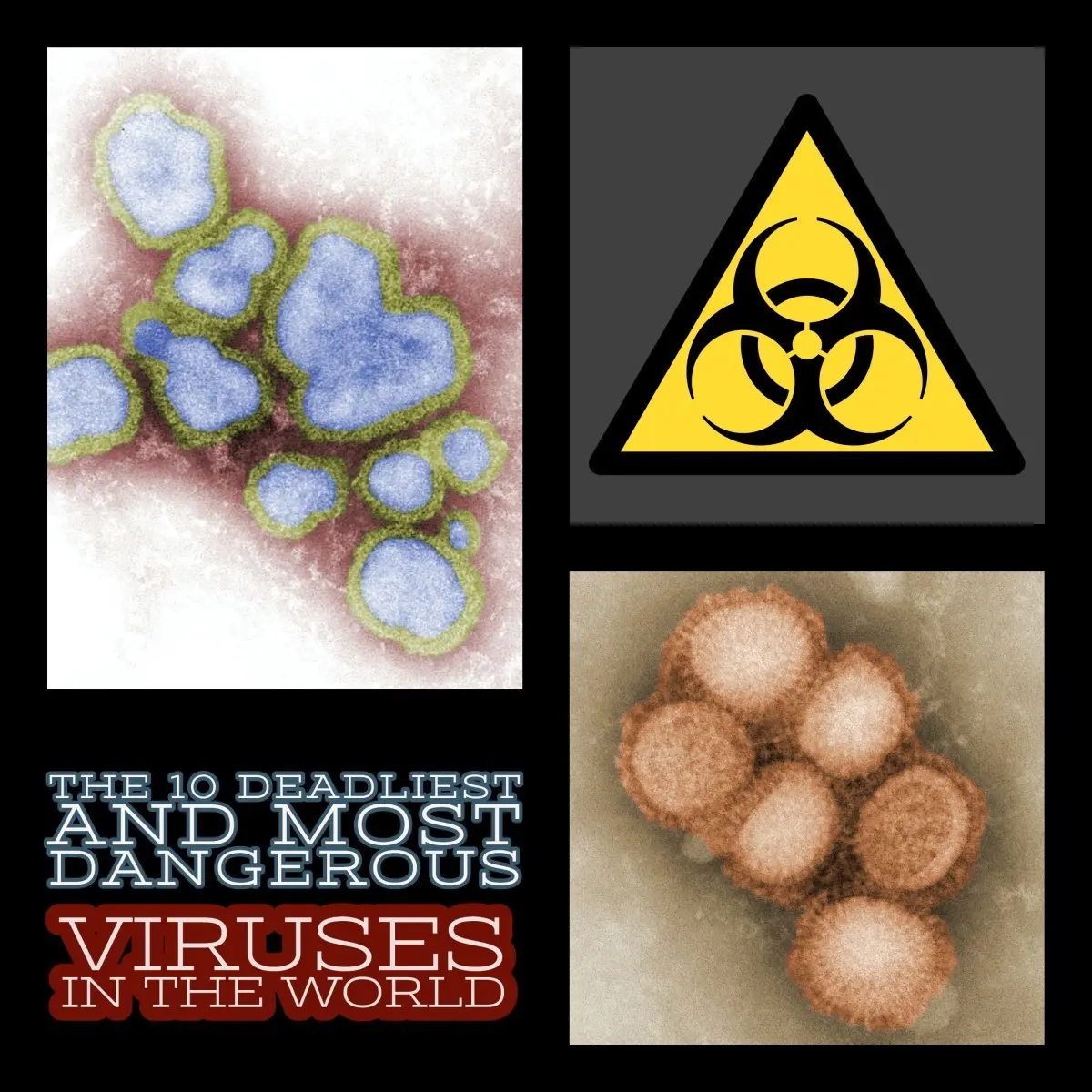 The seven most dangerous viruses in the world