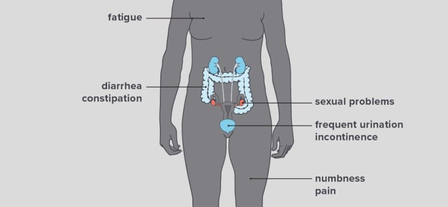 The situation of women with multiple sclerosis. They need support in many areas