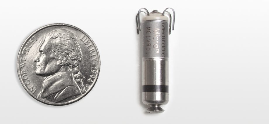 The smallest pacemaker in the world