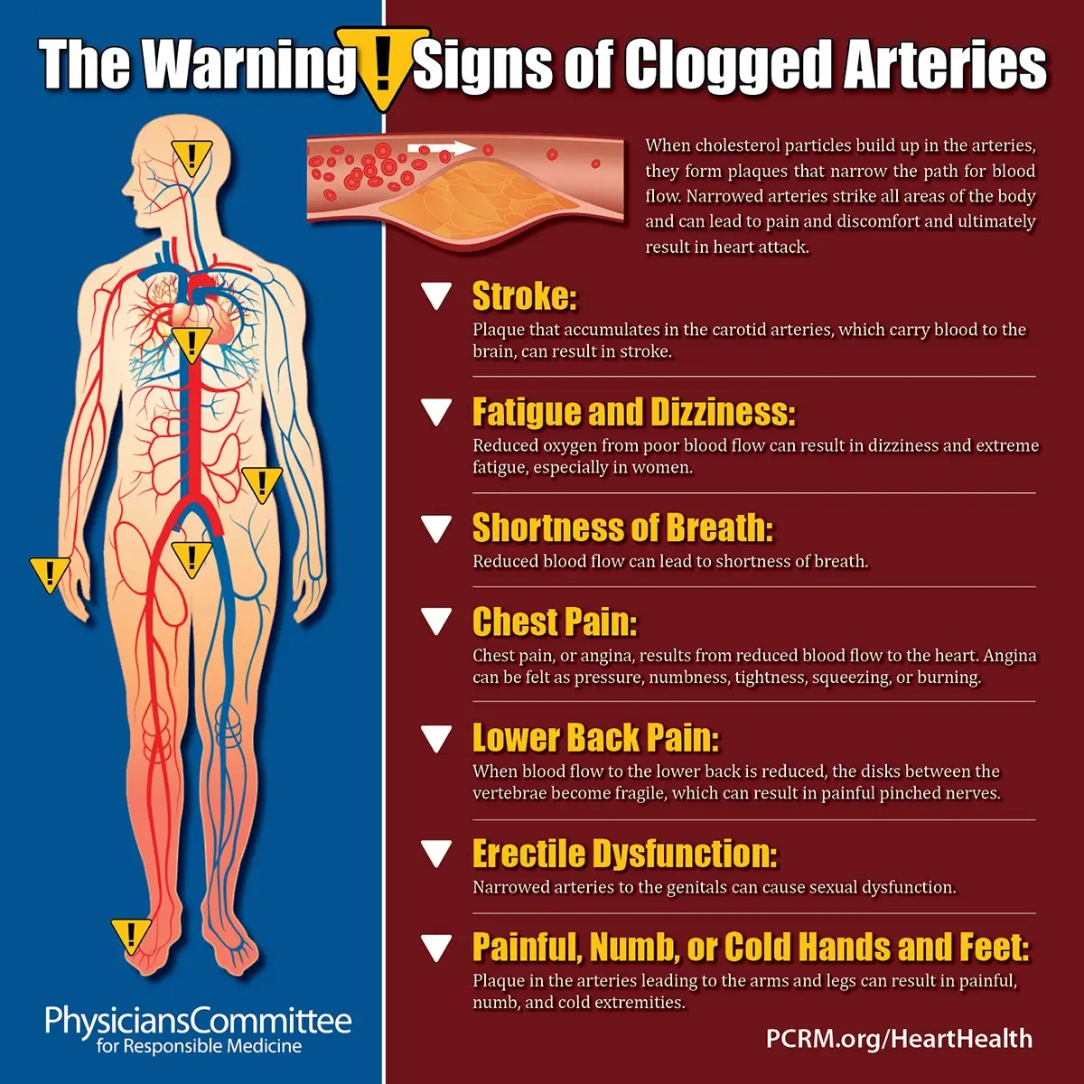 The symptoms of atherosclerosis are hidden for many years. Here are the warning signs of clogged arteries