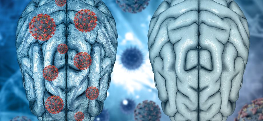 The traces COVID-19 leaves in the brain. Effects felt even after two years