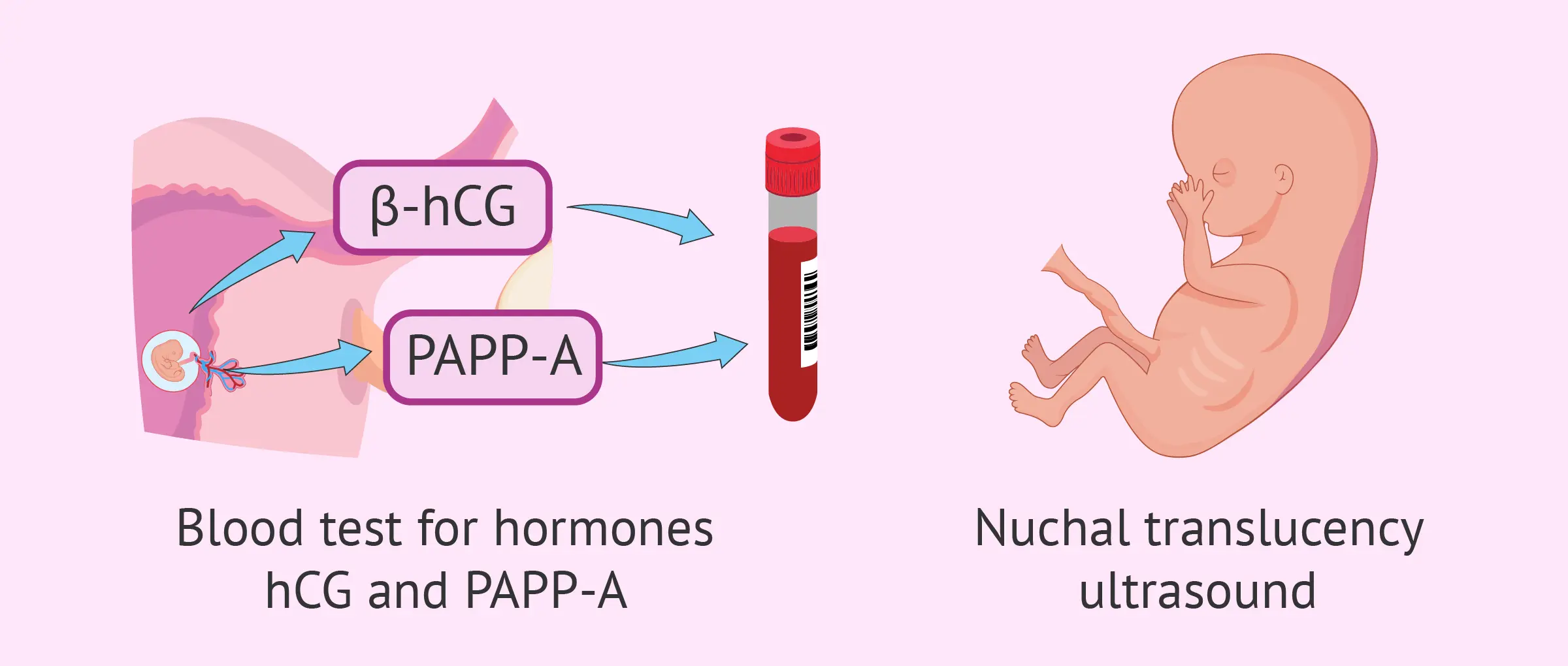 The triple test &#8211; screening for pregnancy. Why is it being performed?