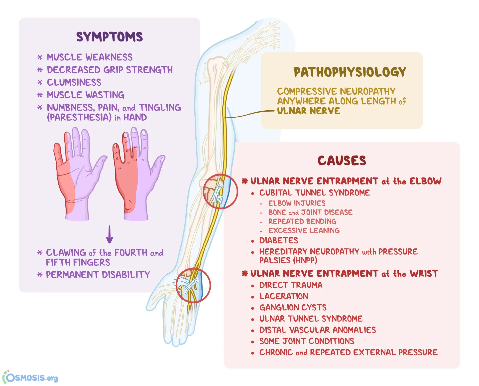 Can Ulnar Nerve Entrapment Cause Chest Pain