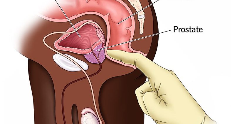 The urologist calls: do this examination. It doesn&#8217;t hurt and only takes a few minutes