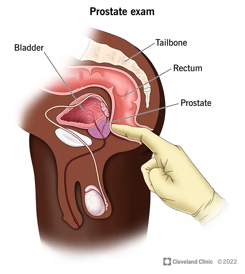 The urologist calls: do this examination. It doesn&#8217;t hurt and only takes a few minutes