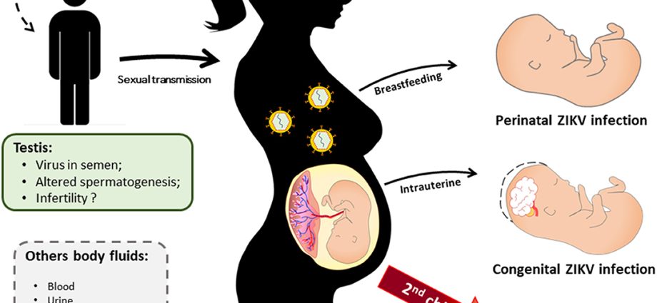 The use of antiviral drugs during pregnancy does not increase the risk of malformations in the newborn