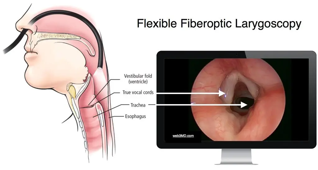 The vocal cords &#8211; their operation and diseases