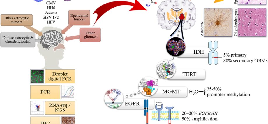 There is no viral basis for breast cancer or glioma