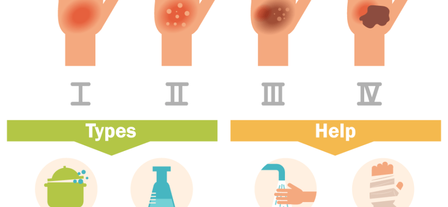 Thermal and chemical burns