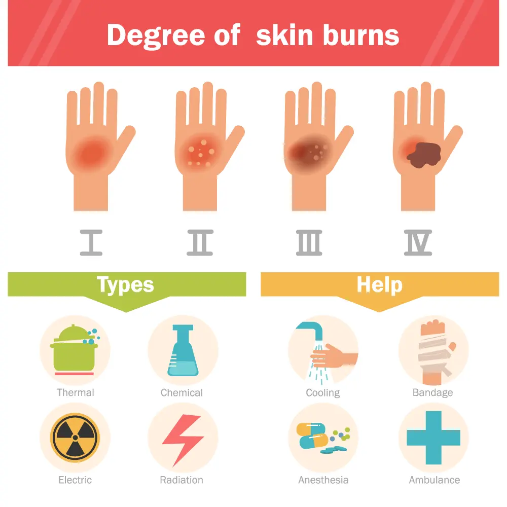 Thermal and chemical burns