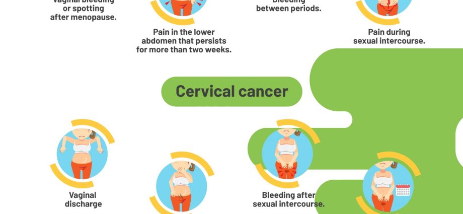 These are the most common gynecological neoplasms. Two of them are easy to spot