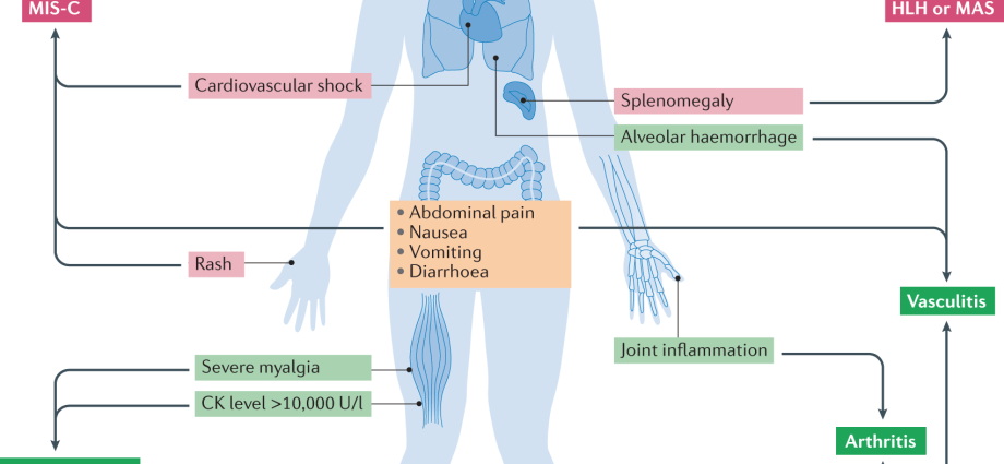 These four organs must be tested if you have recently had COVID-19