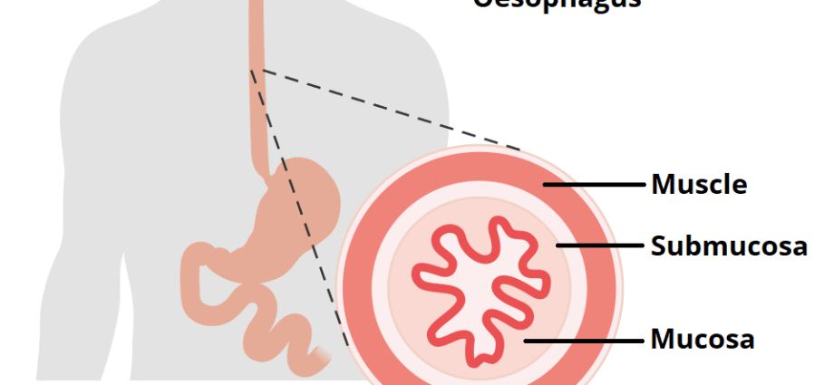 They will make the esophagus from the thigh tissues