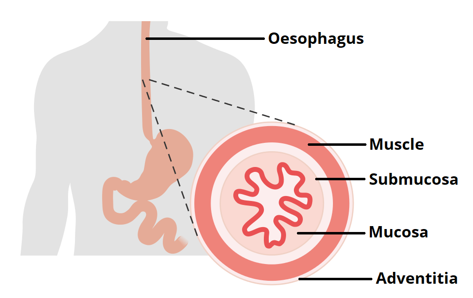 they-will-make-the-esophagus-from-the-thigh-tissues-healthy-food-near-me