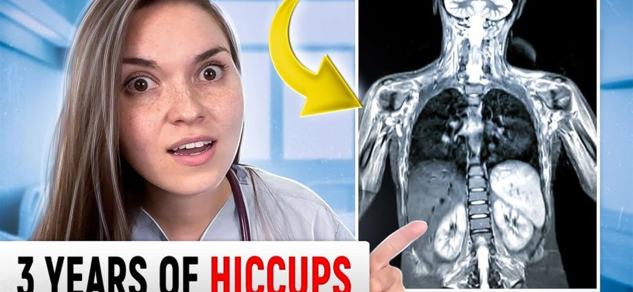 This ailment that affects everyone. The doctor found a solution to the hiccups