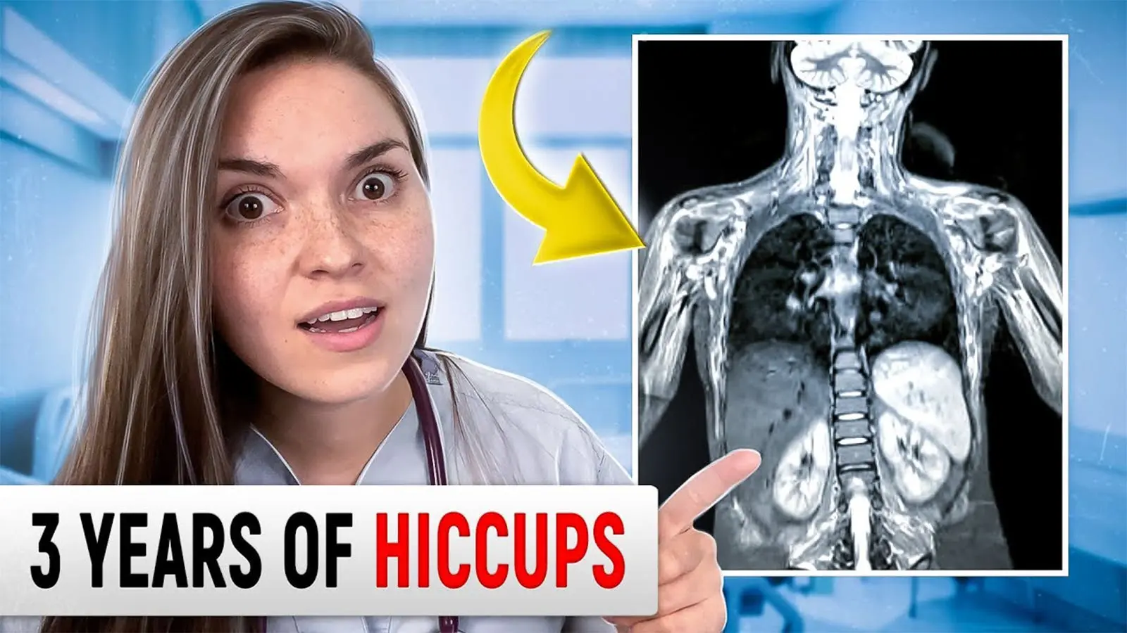 This ailment that affects everyone. The doctor found a solution to the hiccups