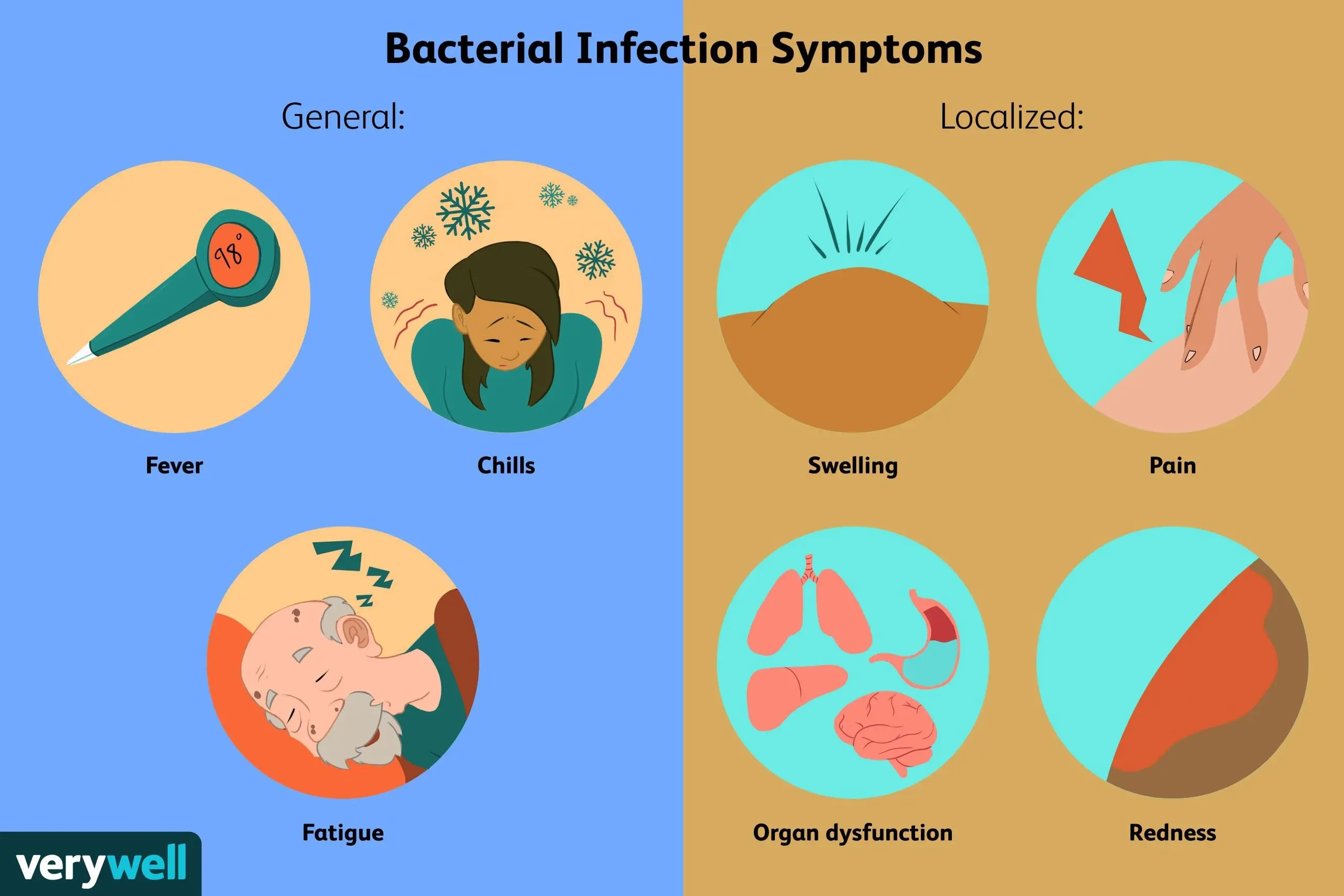 This dangerous bacterium can be infected anywhere. A symptom of frightening pain