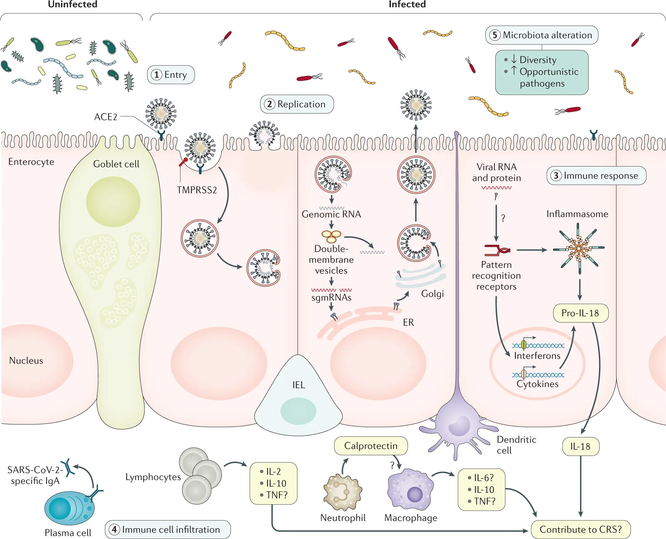 This is how the coronavirus works on the intestines. Even half of those infected have symptoms