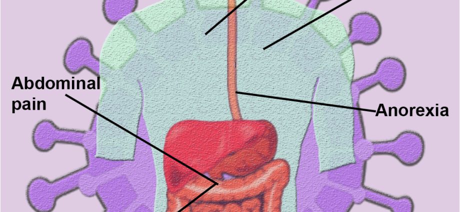 This is how the coronavirus works on the intestines. Pocovid irritable bowel syndrome. Symptoms