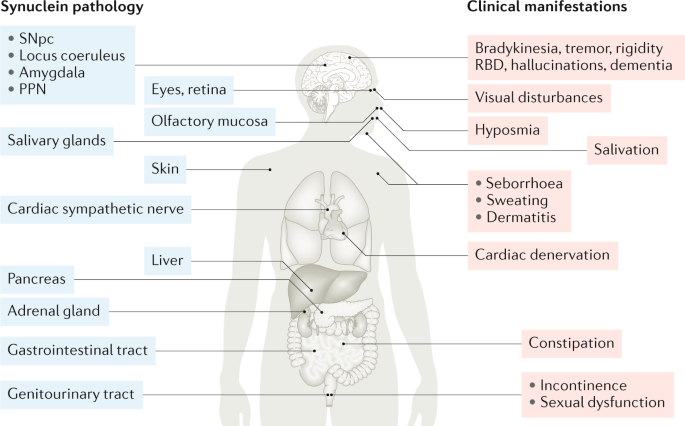 This is how you delay the symptoms of Parkinson&#8217;s disease. Experts have no doubts