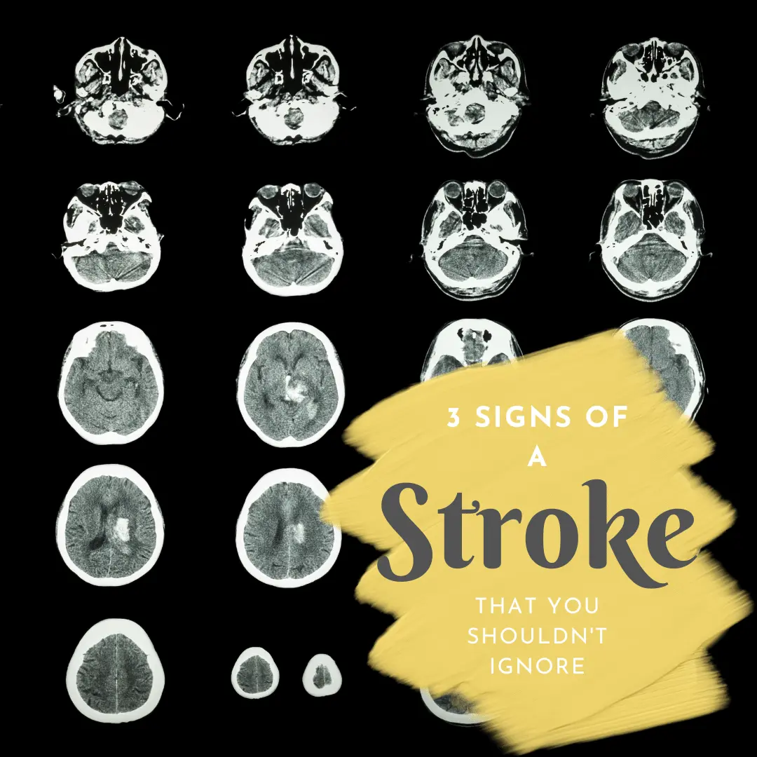 Three symptoms of stroke you can&#8217;t ignore