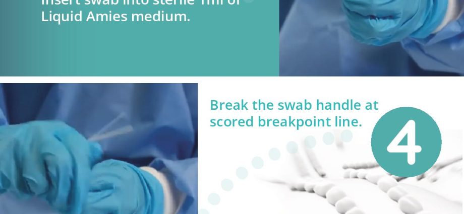 Throat swab &#8211; indications, preparation, course and price of the examination