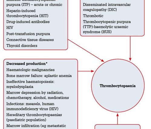 Thrombocytopenia &#8211; causes, symptoms, treatment