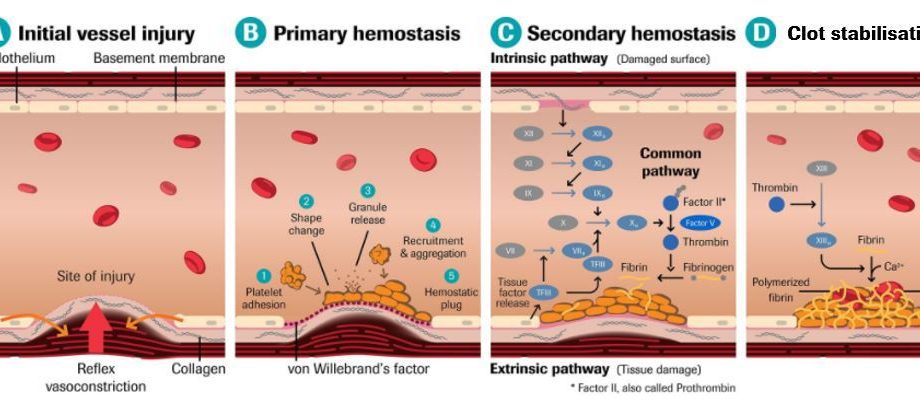 Thrombophilia &#8211; causes and symptoms. Types of thrombophilia