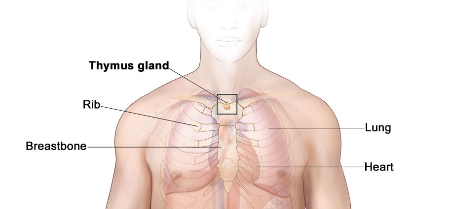 Thymoma &#8211; symptoms, treatment