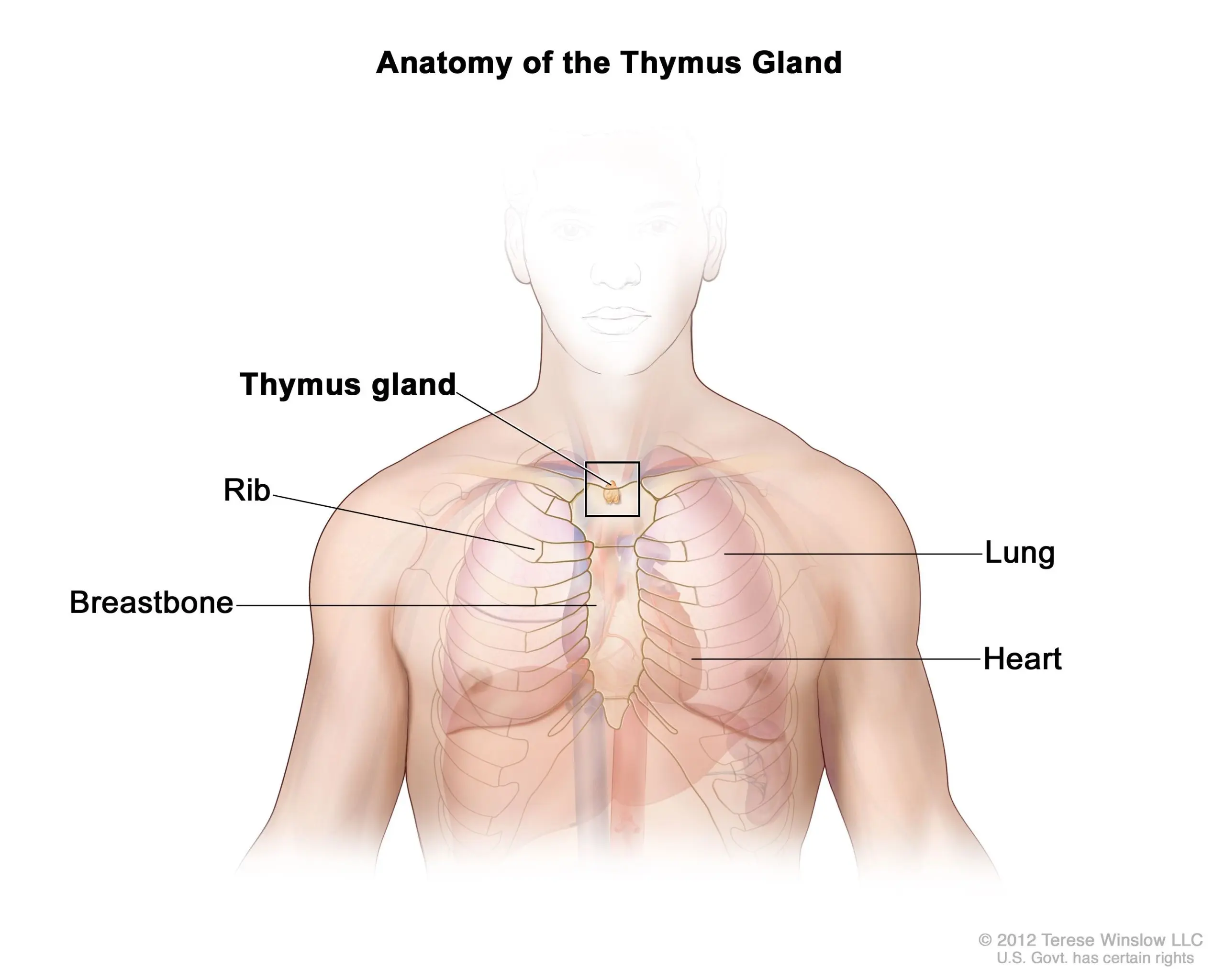 Thymoma &#8211; symptoms, treatment