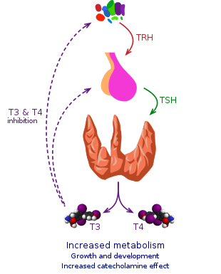 Thyroid crisis