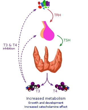 Thyroid crisis