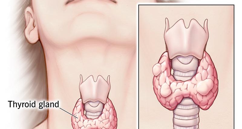 Thyroid Lumps &#8211; Can They Be Dangerous?